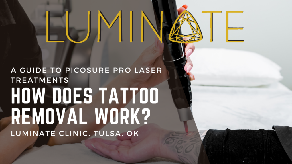 Person receives PicoSure Pro tattoo removal treatment on inner wrist